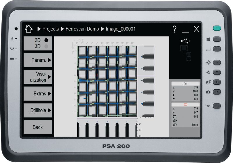 PSA 200 applikationssoftware App til visualisering og analyse af scannede data fra Ferroscan- og X-Scan-scannere på PSA 200-tabletten